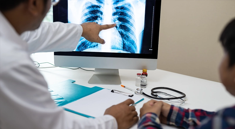 TB Then & Now: Koch’s Discovery Meets Modern Diagnostics