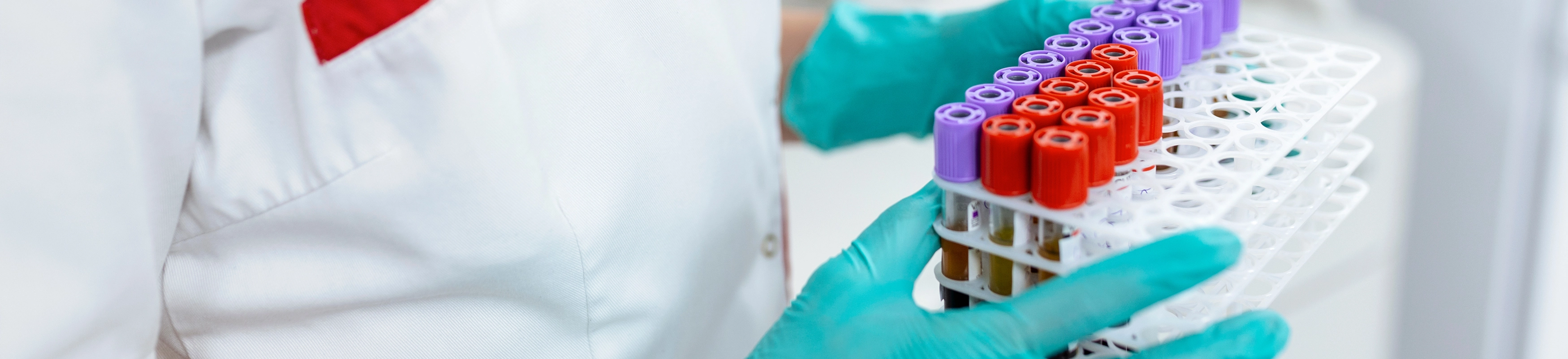 Quality Controls: The Unsung Hero of Molecular Diagnostics